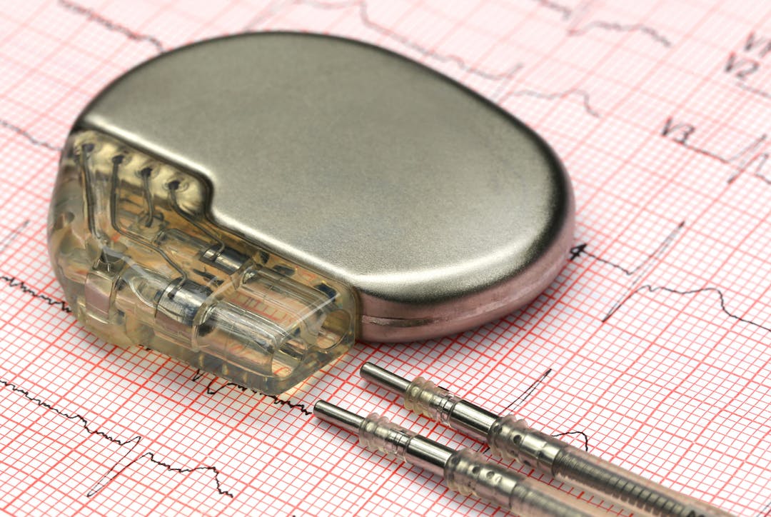 Electrocardiograph with pacemaker stock photo