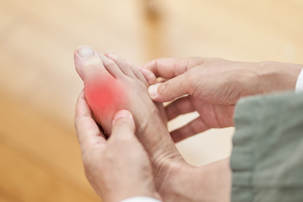 The feet of a man suffering from foot pain stock photo